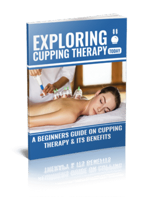 Exploring Cupping Therapy Today
